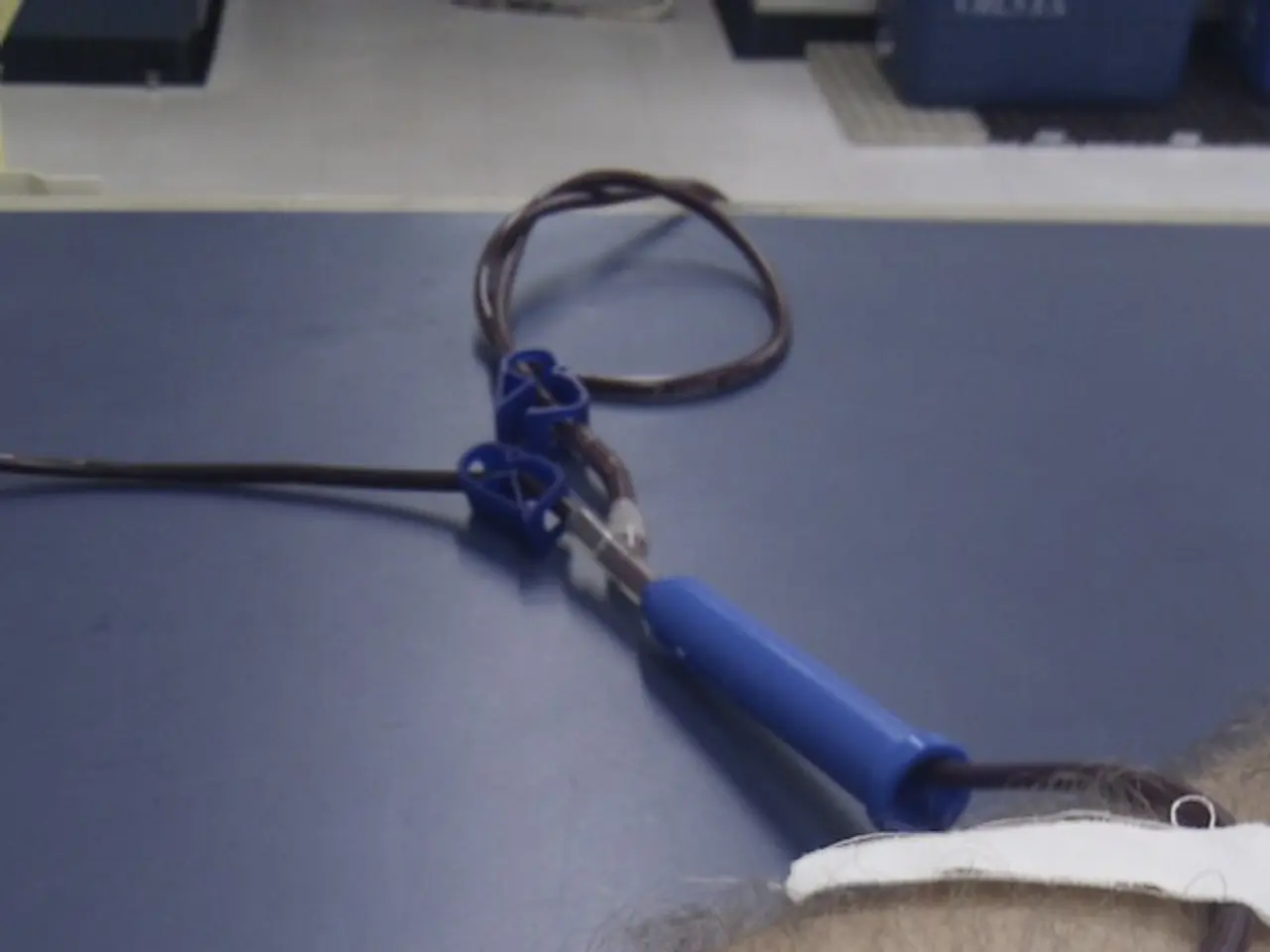 Tonsil Excision: Key Points on Removing Tonsils