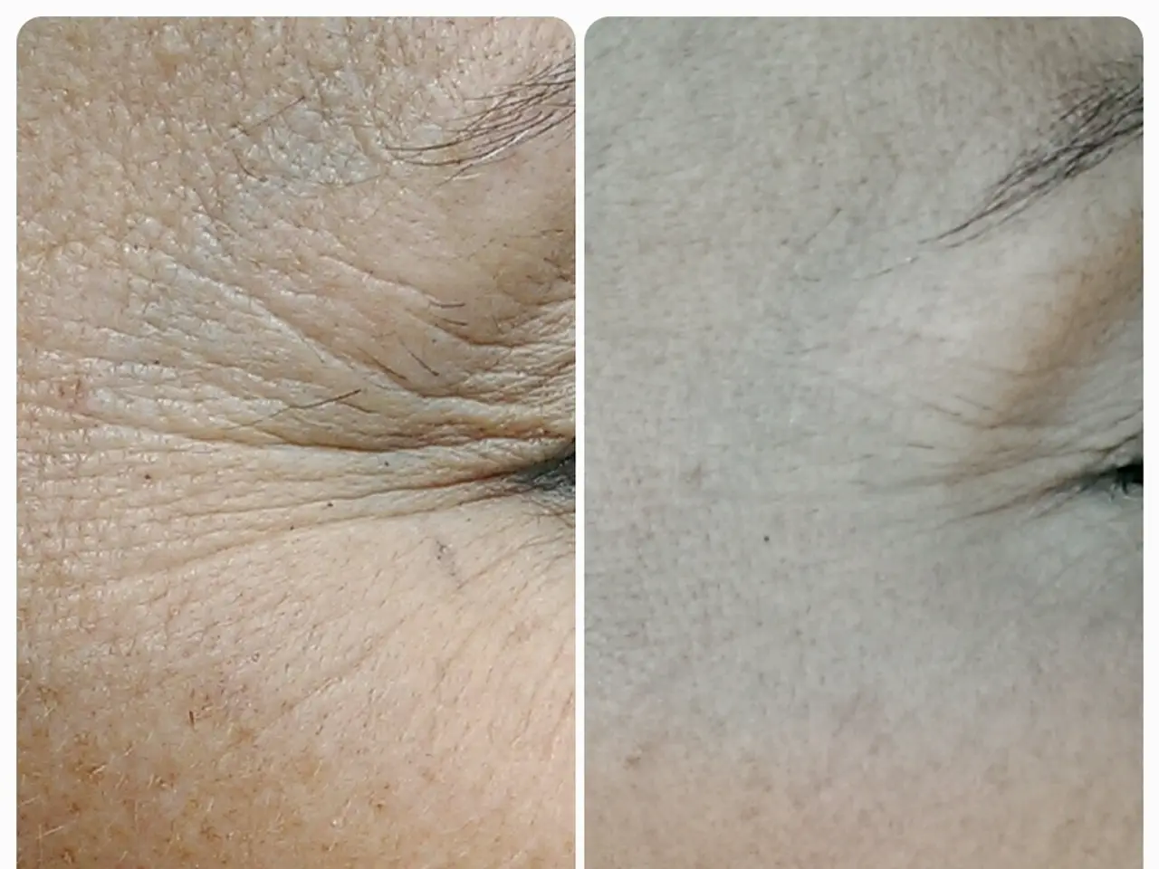 Face Care Sequencing Query: Which Order Should I Apply Face Moisturizer and Face Serum?