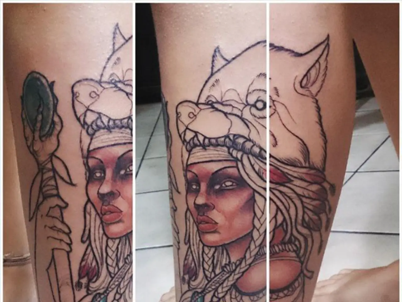 Stroke Recovery Process: Exploring Brunnstrom Stages, Duration, and Additional Details