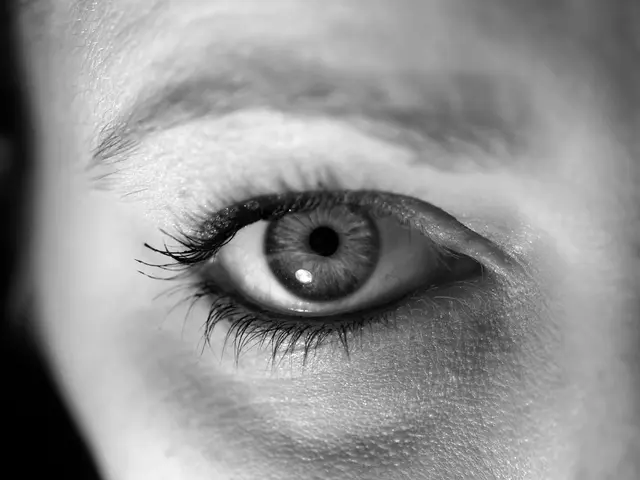 Eye Condition: Atopic Keratoconjunctivitis - Symptoms, Triggers, and Remedies