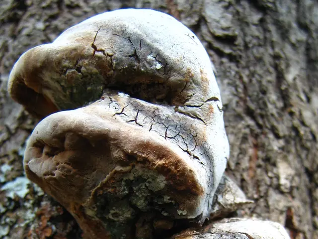 Lung granulomas encased in calcium: Signs, origins, and additional details