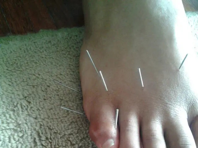 Groin Lymphoma: Recognizing Symptoms, Understanding Causes, Diagnosing, and Treatment Strategies