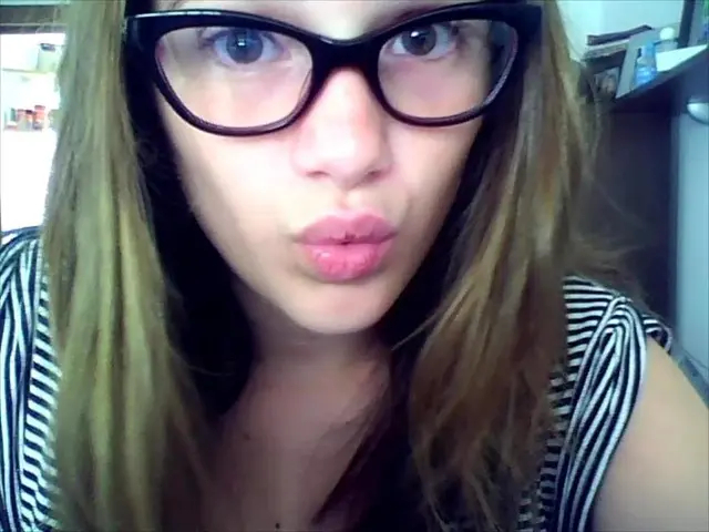 Cataract Surgery Follow-ups: Varieties and Recipients