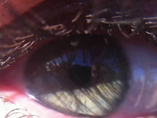 Diabetic Eye Disease Explained: An Overview