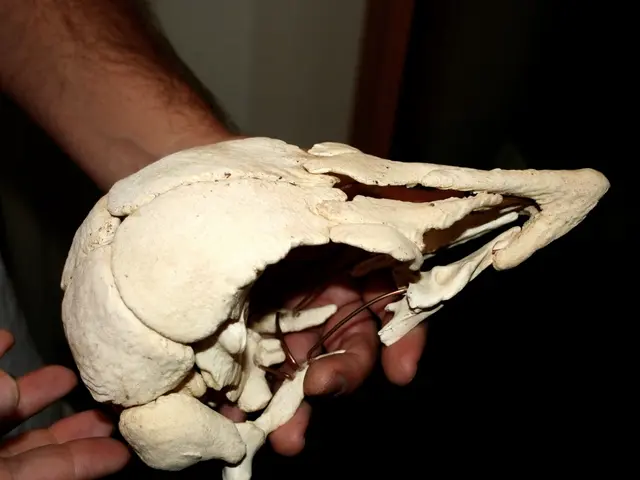 In this image I can see cream colored bone structure in a human hand. I can see the white, brown...